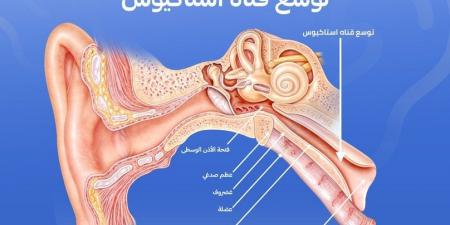 كيف نمنع تطور التهاب الأذن الوسطى أثناء نزلات البرد؟ - بوابة فكرة وي