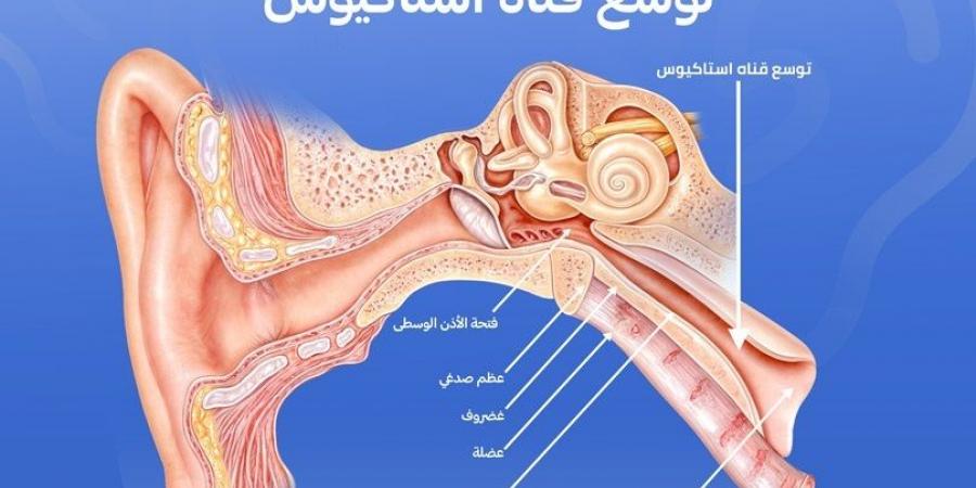 كيف نمنع تطور التهاب الأذن الوسطى أثناء نزلات البرد؟ - بوابة فكرة وي